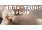 Имплантация зубов в стоматологической клинике Дентамед